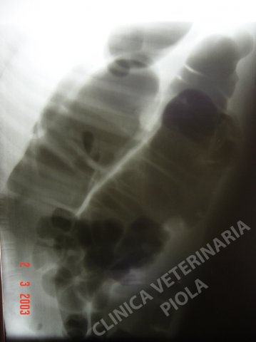 Ileo paralitico da sepsi